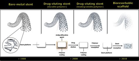 why are bare metal stents fabricated from steel or nitinol|metallic stents reviews.